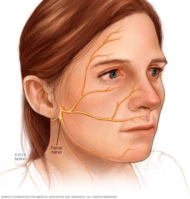 facial nerve yüz felci ramsay hunt